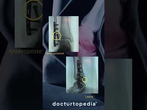 Juan Pedro Martínez Ávila-9