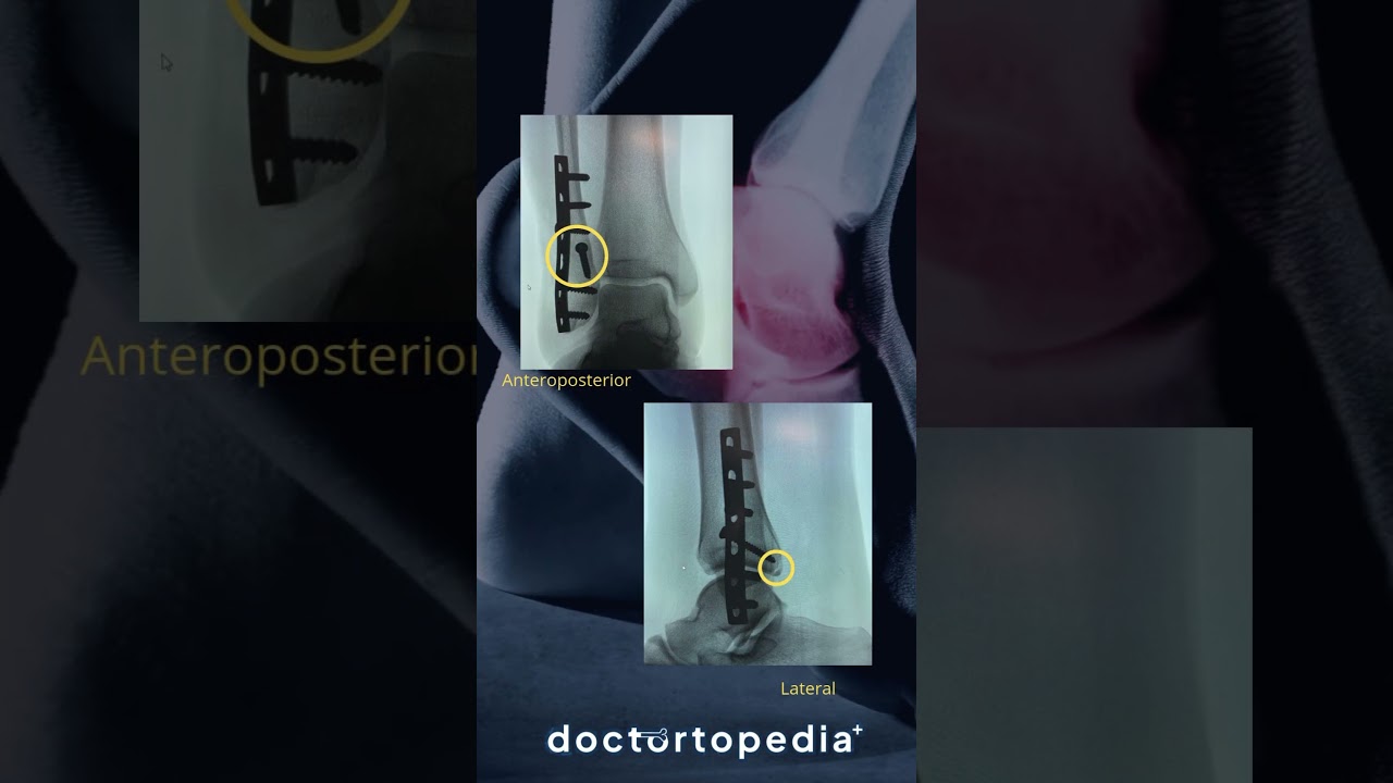 Juan Pedro Martínez Ávila-9