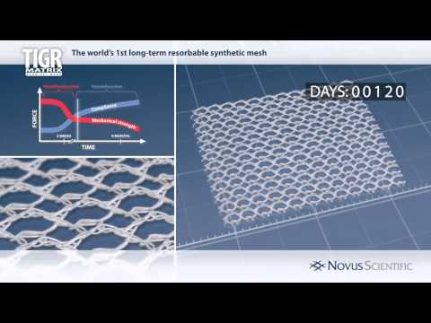 TIGR® Matrix basic function