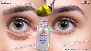In 3 days Remove Under Eye Bags Completely | Remove Dark Circles, Wrinkles, and Puffy Eyes