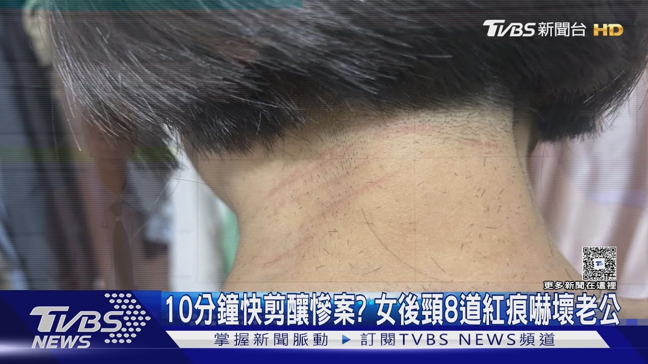 10分鐘快剪釀慘案? 女後頸「8道紅痕」嚇壞老公