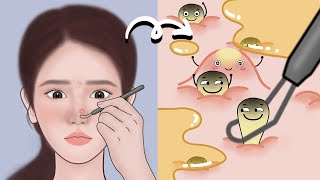 The correct way to squeeze acne, the scene is absolutely comfortable~丨Meng's Stop Motion