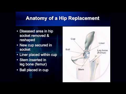 Hip Replacement Surgery