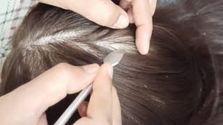 ✨✨ ASMR Detailed Scalp Exam With Sensory Tests ( Real Person) #hair #asmr #tingles
