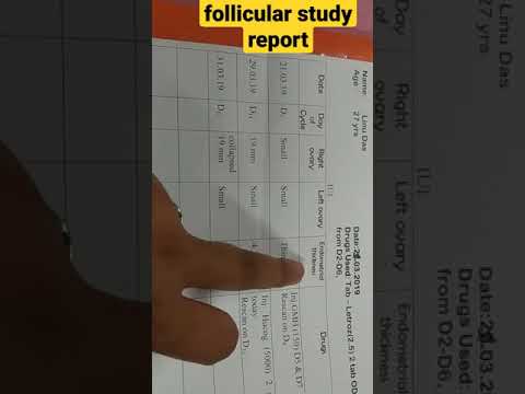 follicular study report #follicular #follicularusg #follicularstudy #usg