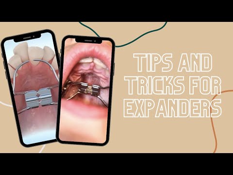 Tips & Tricks for Expanders #shorts