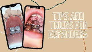 Tips &amp; Tricks for Expanders #shorts