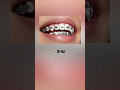 Braces colors that don't stain