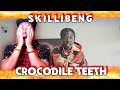 Skillibeng  | Crocodile Teeth (REACTION)