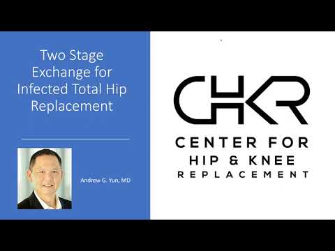 Two Stage Exchange For Infected Total Hip Replacement