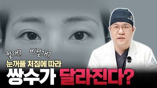 눈꺼풀 처짐 정도에 따라 달라지는 쌍수 방법 #오엠성형외과 박용식 원장