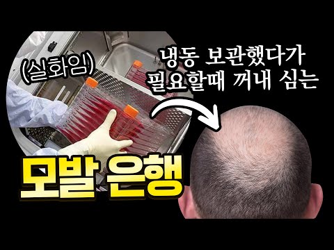 ※주목※ 모발 은행이라고 들어보셨나요? - 뉴헤어 I 모발이식