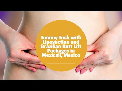 Flawless Tummy Tuck with Liposuction and Brazilian Butt Lift Packages in Mexicali, Mexico