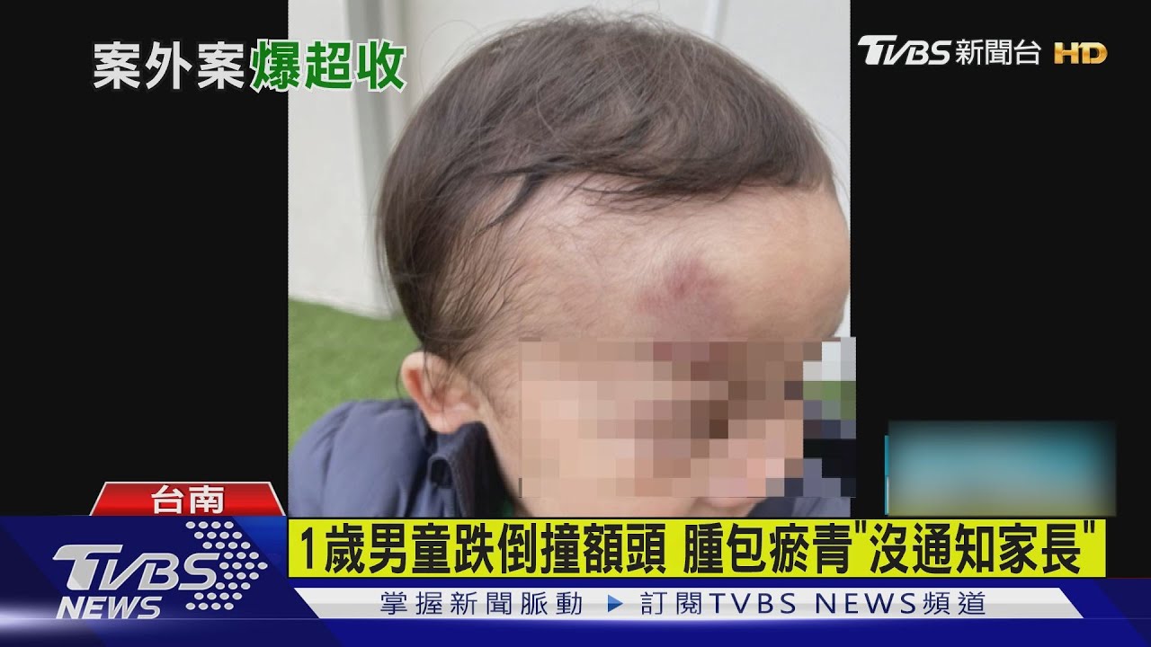 夾掀指甲+額頭瘀青!2幼童連環傷 托嬰中心爆超收