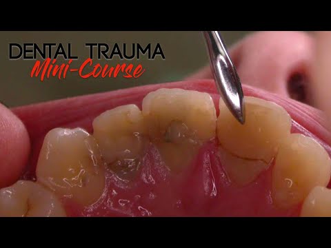 Dental Trauma Mini-Course - Part 2 - Dental Trauma Worksheet