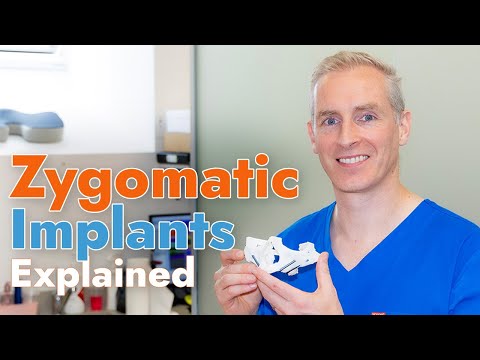 Explaining Zygomatic Implants: A Revolution in Dental Restoration! - 3Dental