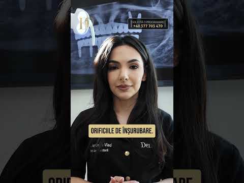 Lucrare înșurubată sau cimentată pe implanturi – diferențe și indicații