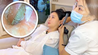 Experience Shenzhen's Visual Ear Cleaning and Ear Washing ASMR—A Tingling Sensation for Your Ears