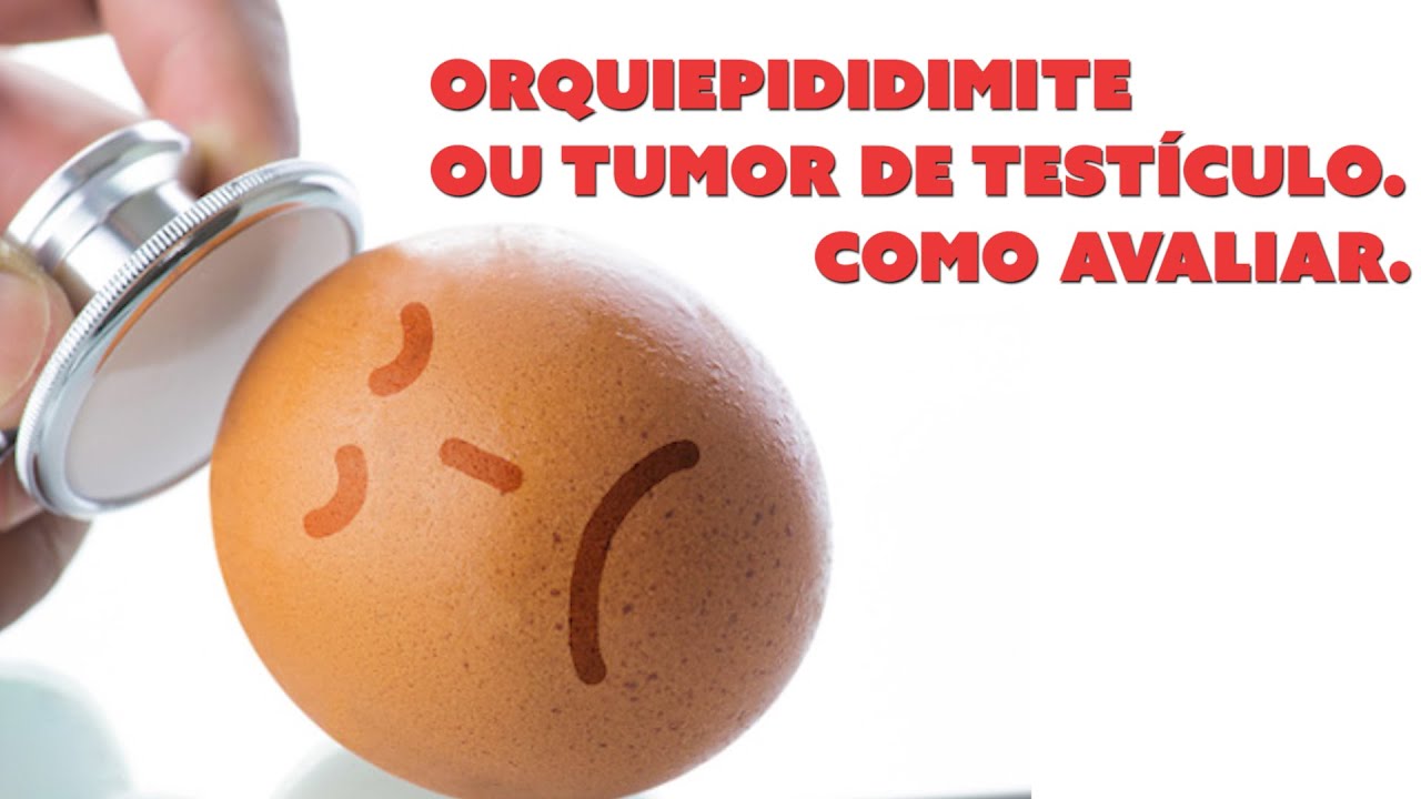 Charles Rosenblatt-21