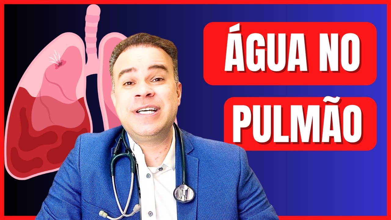 ÁGUA NO PULMÃO | LÍQUIDO PLEURAL | EDEMA AGUDO DO PULMÃO