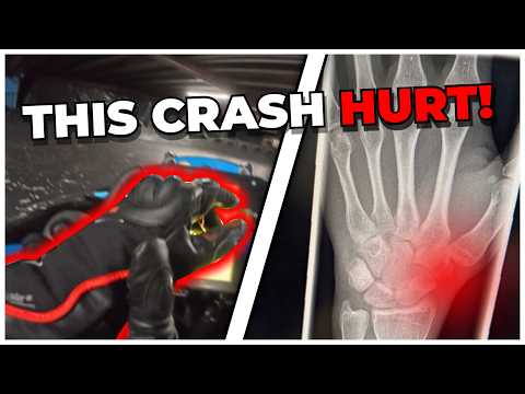 I SPRAINED MY WRIST at TeamSport Warrington