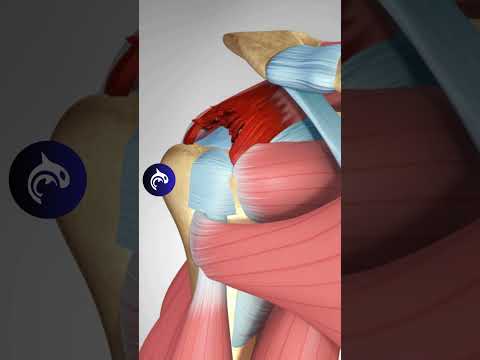 Rotator Cuff Tear and Surgical Repair - 3D Animation