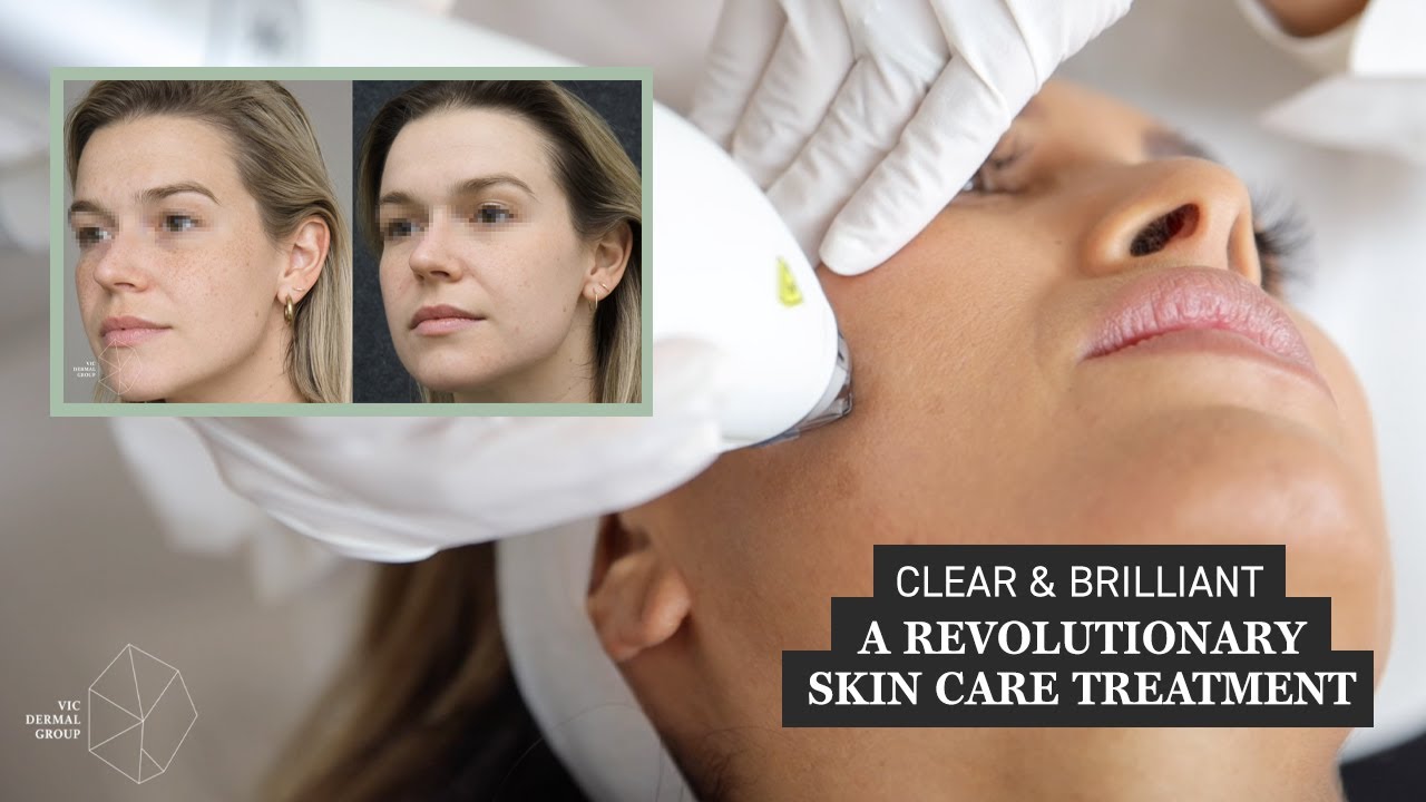 Clear & Brilliant Treatment - Fight The Effects Of Ageing Skin | Victorian Dermal Group