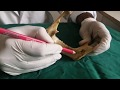 Anatomy And Demonstration Of Inferior Alveolar Nerve Block 3rd BDS Class