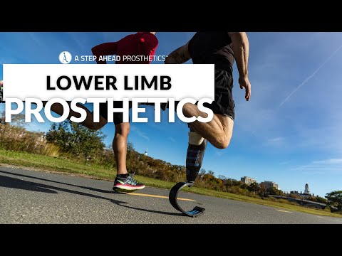 Anthony testing his Ottobock Genium X3 knee