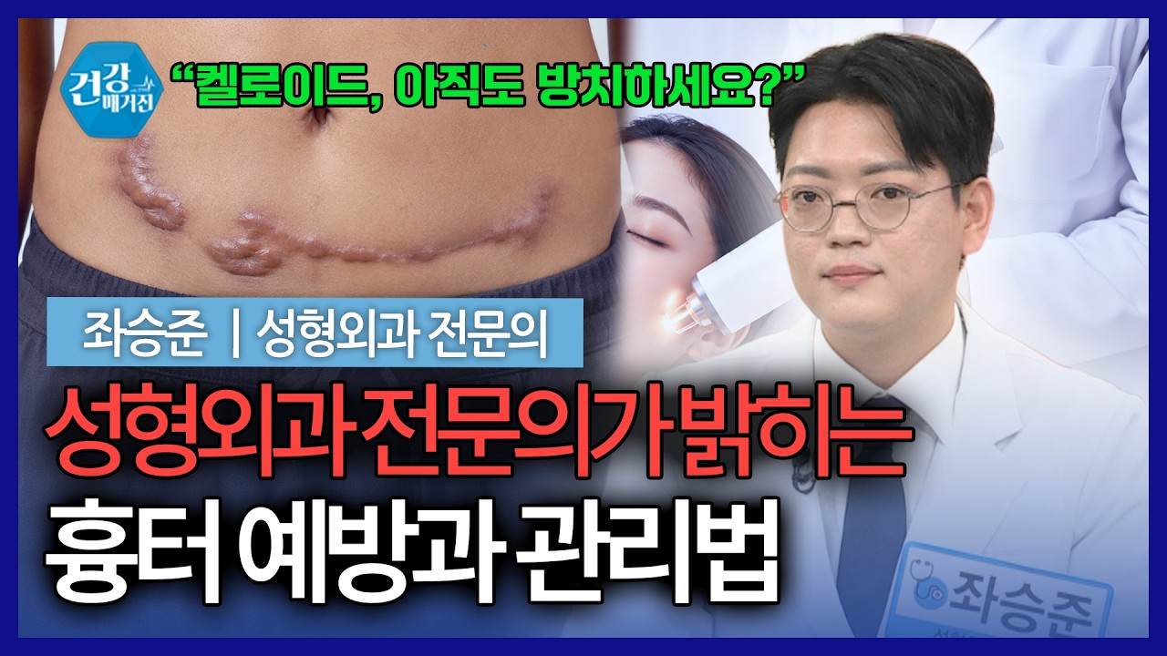 패이고 튀어나온 흉터… 오래된 켈로이드도 치료 가능할까? [건강매거진]