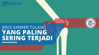 Osteosarcoma, Jenis Kanker yang Paling Umum pada Tulang dan Sering Disebut Sarkoma Osteogenik