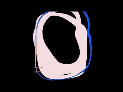 Roberto Auser - Gentrified