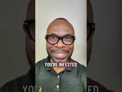 Reptiles living in your head.  #torchTheForest #BurnTheZoo