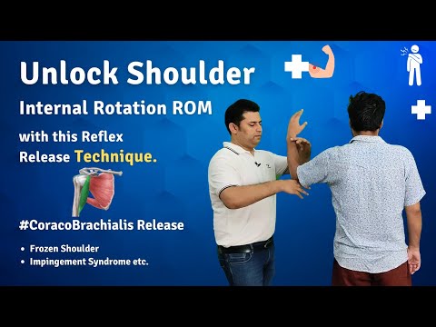 Frozen Shoulder Treatment 7 Stage Shoulder Mobilization Technique Spencer s Technique