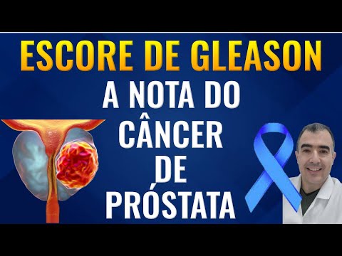 opzioni di chirurgia della prostatite