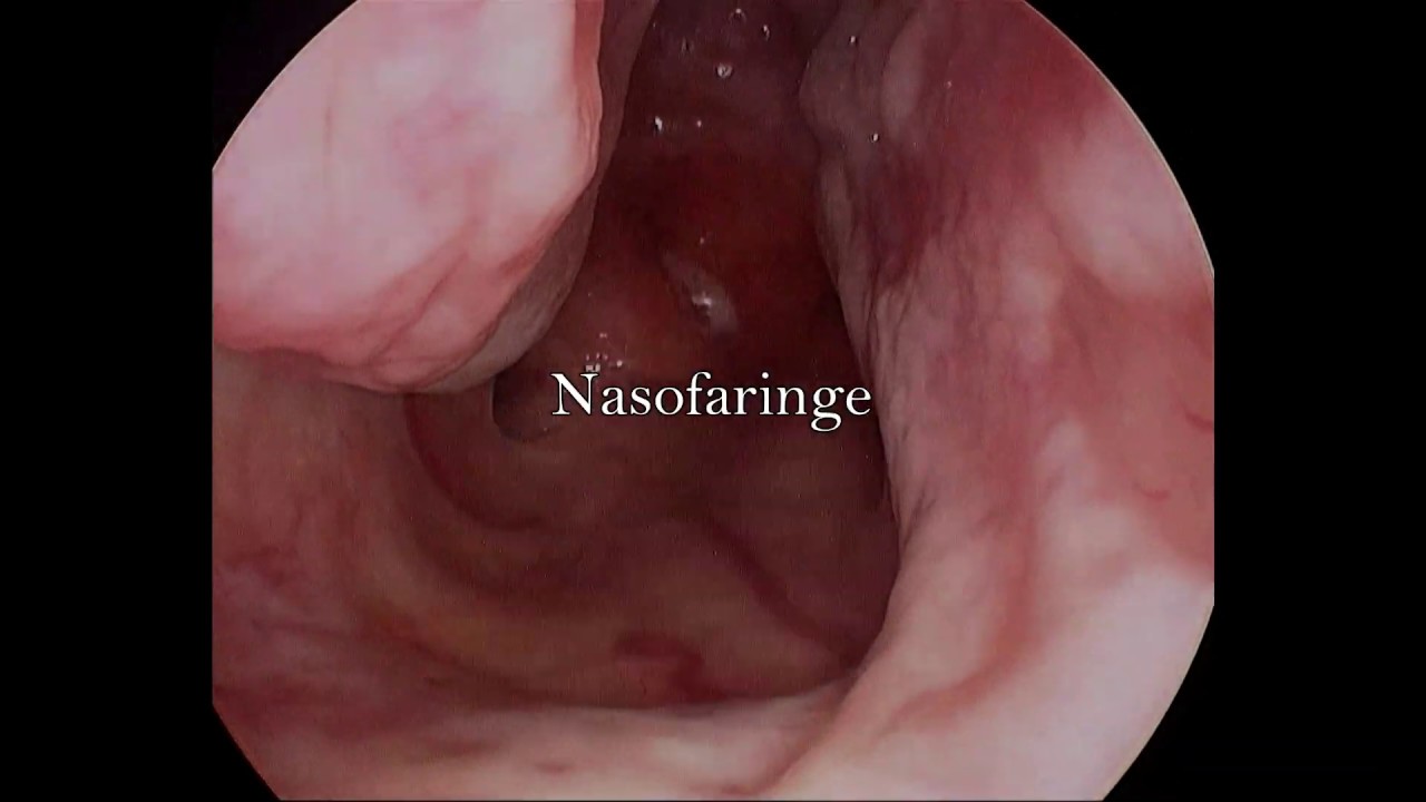 Carlos Alberto Silva Torres-8