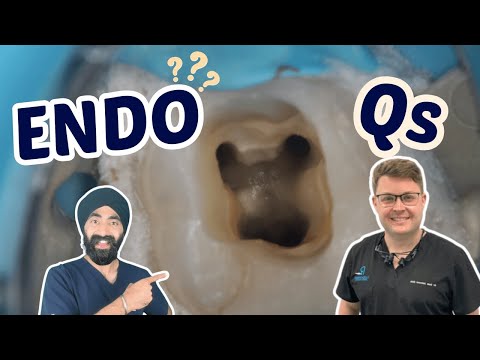 Your Endodontics Questions Answered! - PDP217