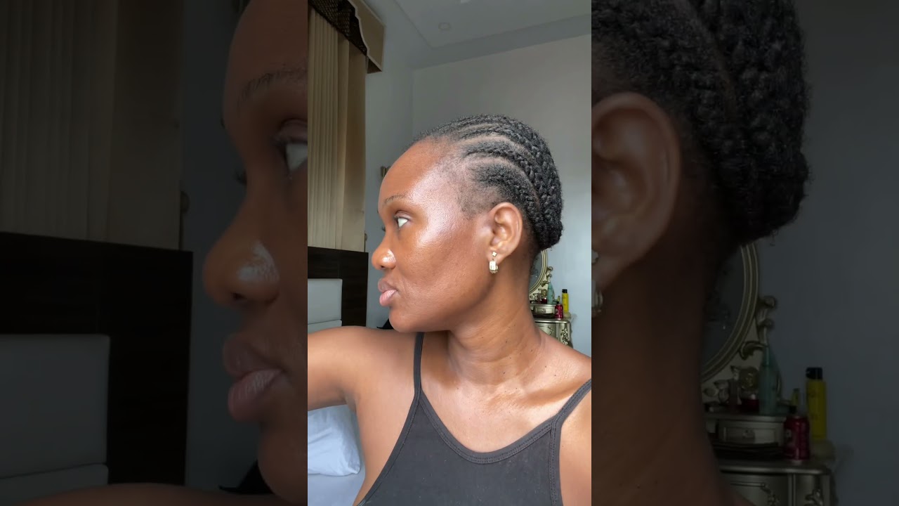 How I treat my hyperpigmentation| Uneven skin tone |Textured skin| The Ordinary glycolic acid #short