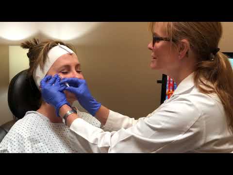 WHY USE A MICROCANULLA AND PRF