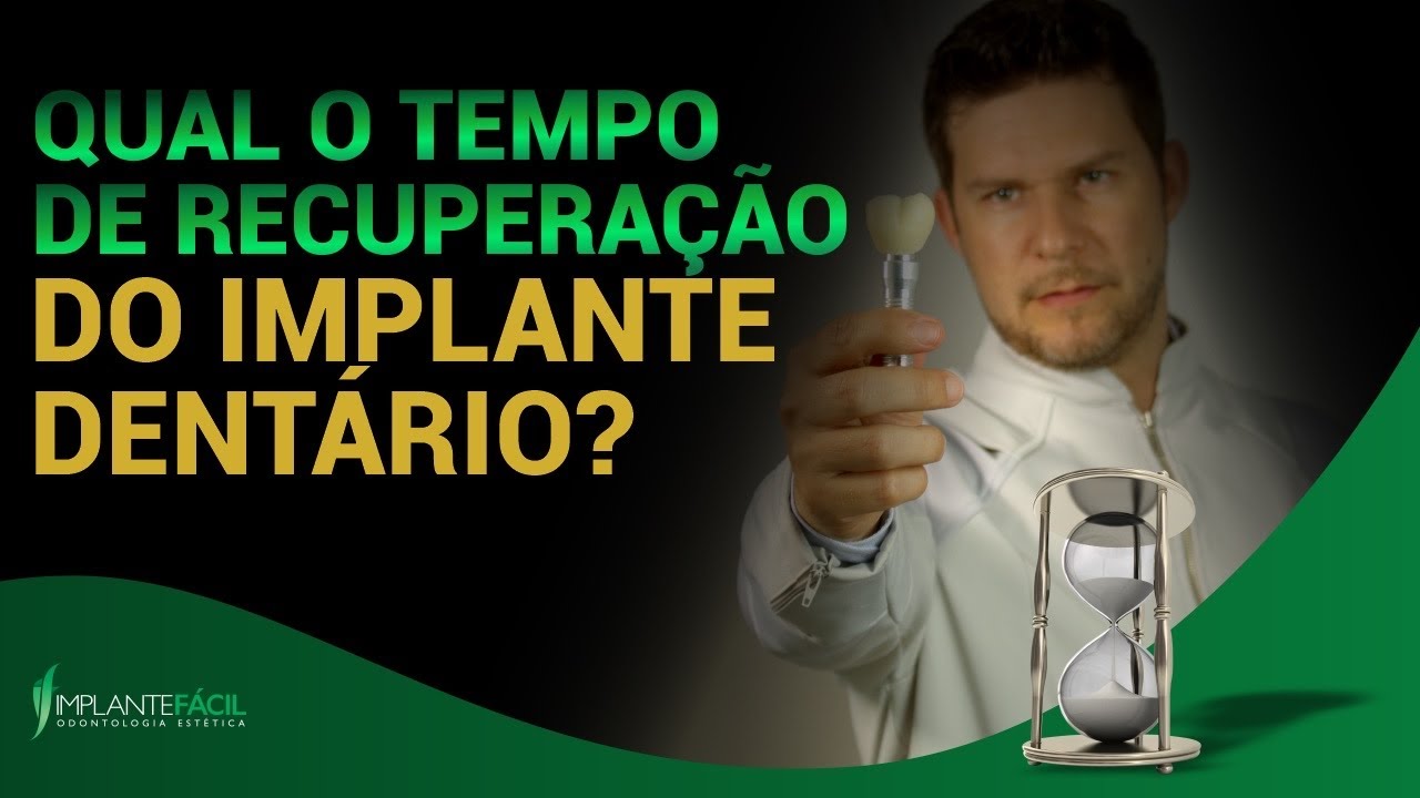 Qual o Tempo de Recuperação do Implante Dentário