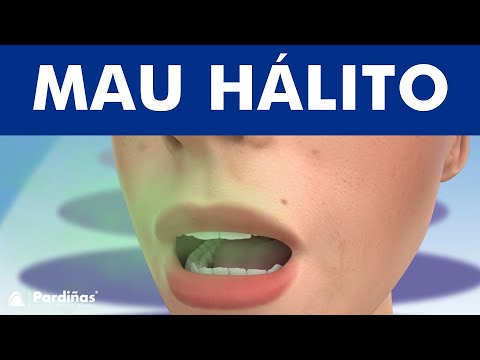 Halitose – Mau hálito ©