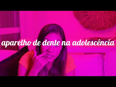 APARELHO DE DENTES NA ADOLESCÊNCIA | Camila Gaio