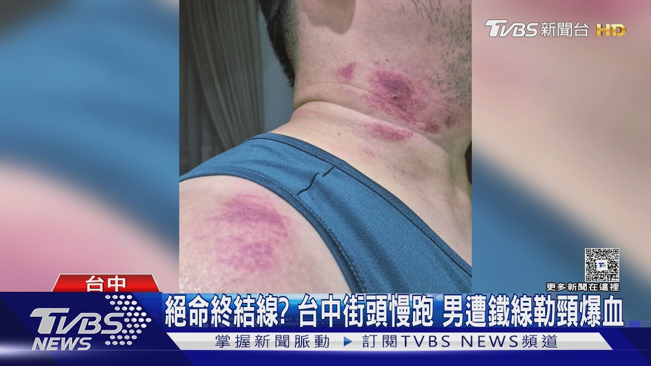 台中男跑步返家「脖子被勒」噴血　兇手竟是燈桿鐵線