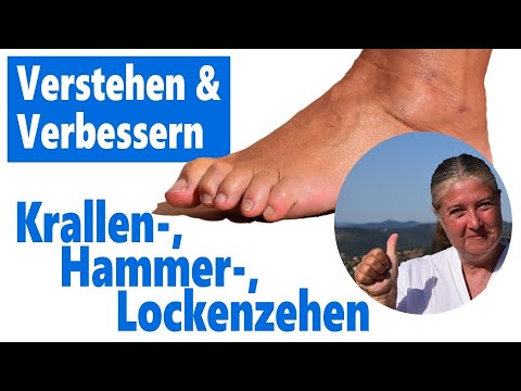 Verstehen und Verbessern:  Krallen-, Hammer- und Lockenzehen