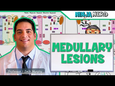 Stroke Syndromes MCA ACA ICA PCA Vertebrobasilar Artery Strokes Pathophysiology