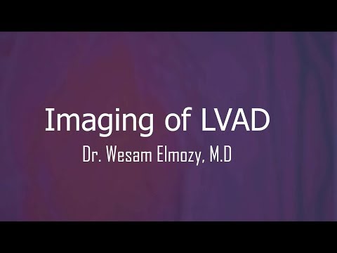 advanced imaging technologies in LVAD treatment