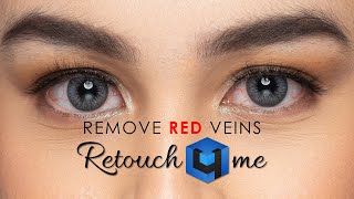 How to remove red veins on eyes in Photoshop featuring Retouch4ME