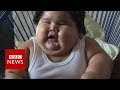 Why is this baby so overweight? - BBC News