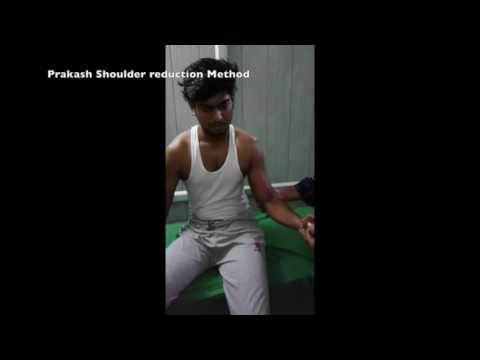 The Prakash Method Of Shoulder Reductions
