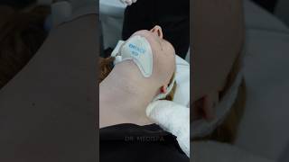 Say goodbye to your double chin with Emface Submentum | Dr. Medispa